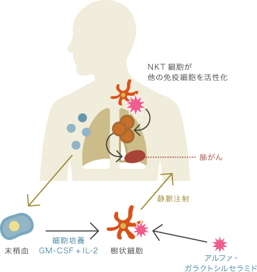 アジュバント免疫細胞療法の説明図
