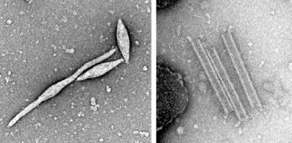 日本の望月らのグループが発見した、レモン(紡錘)型のAPSV1(左)とバネ・コイル型ACVの超好熱古細菌ウイルス。ともに培養温度は90-95℃。:画像