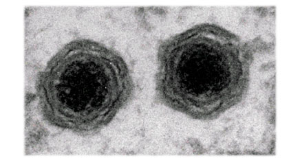 ヘテロシグマ・アカシオ（植物性プランクトンの一種）に感染するウイルスHaV（ヘテロシグマ・アカシオウイルス）の電子顕微鏡像（直径 約200 nm）:画像