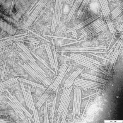 タバコモザイクウイルスの電子顕微鏡写真（Wikimedia Commons、撮影者：T. Moravec、パブリックドメイン）:画像