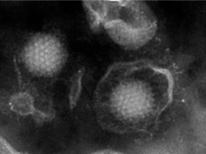 Cyprinid Herpesvirus 2の電子顕微鏡写真（写真提供：東京海洋大学　佐野元彦）:画像