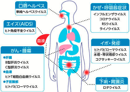 ウイルスがヒトに引き起こす疾患や症状の例:画像