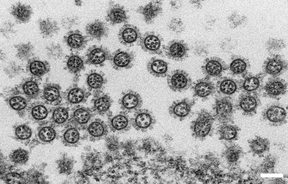 透過電子顕微鏡によるインフルエンザウイルス粒子の超薄切片像:画像