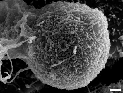 走査電子顕微鏡によるインフルエンザウイルス感染細胞表面像:画像