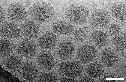 走査電子顕微鏡によるインフルエンザウイルス感染細胞表面像:画像