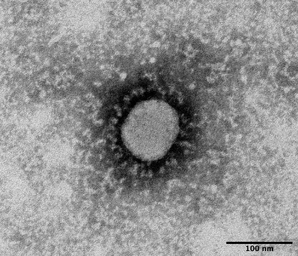 球状のウイルス粒子の例：SARSコロナウイルス２:画像