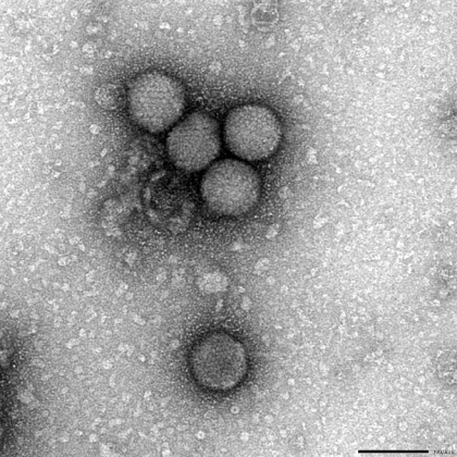 正20面体のウイルス粒子の例：アデノウイルス:画像