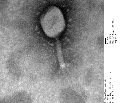 まるで宇宙船のような形のウイルス粒子の例：バクテリオファージT4:画像