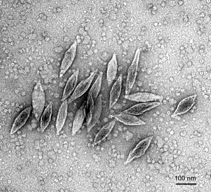 まるでレモンのような形のウイルス粒子の例：古細菌ウイルス:画像1