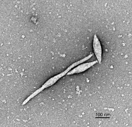 まるでレモンのような形のウイルス粒子の例：古細菌ウイルス:画像2