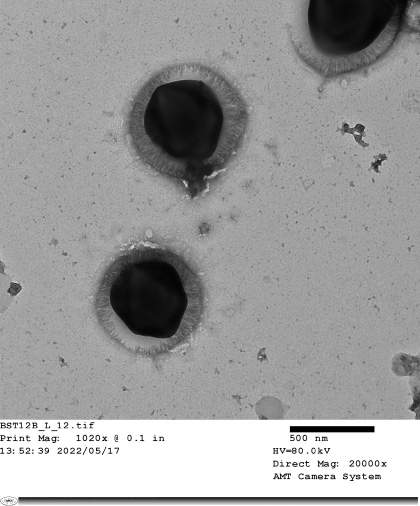 電子顕微鏡で観察したミミウイルス:画像