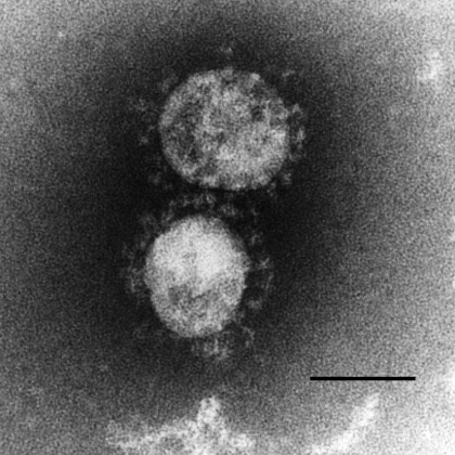 ARSコロナウイルス:画像