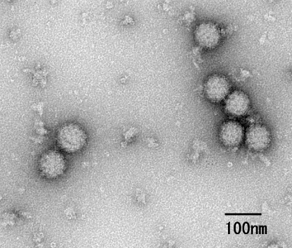 チクングニアウイルス（写真は人工的に合成したウイルス様粒子）:画像