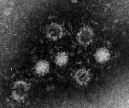 E型肝炎ウイルス:画像