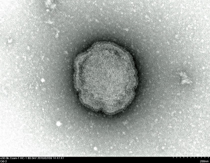 ムンプスウイルス:画像