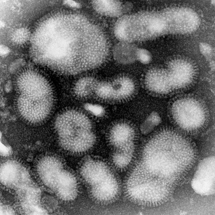 A型インフルエンザウイルス（H3N2亜型):画像