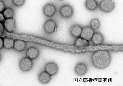 B型インフルエンザウイルス:画像