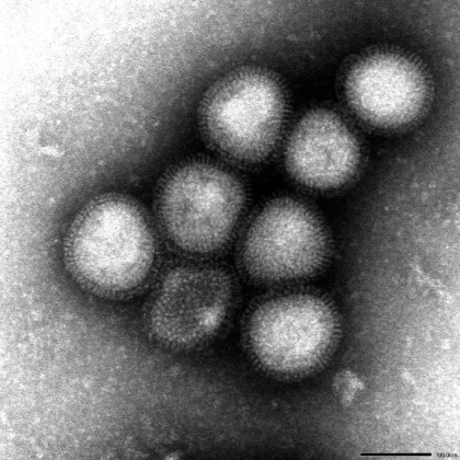 A型インフルエンザウイルス（H7N9亜型）:画像