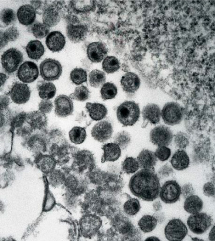 ヒト免疫不全ウイルス1型（HIV-1）:画像