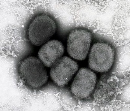 天然痘（痘瘡）ウイルス:画像