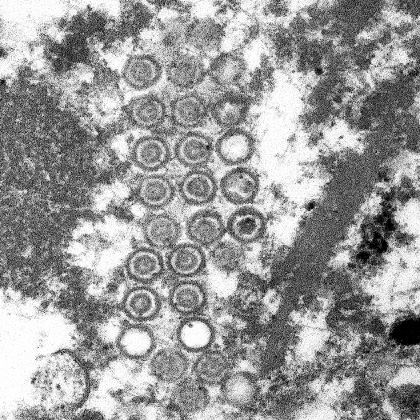 単純ヘルペスウイルス2型（HSV-2）:画像