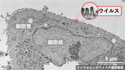 インフルエンザウイルス感染細胞の電子顕微鏡写真画像
